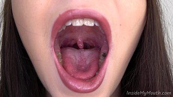 Long uvula and huge throat